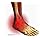 Supreme Silicone Gel Orthotic Insole Plantar Heel Support Cushion Pad