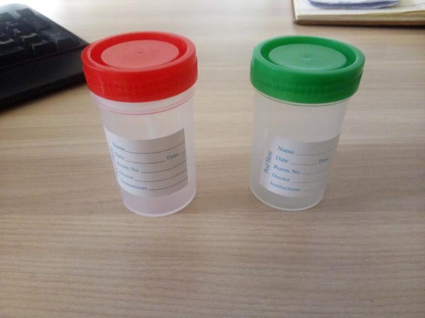 Urine Collection Container, for Hospital,
