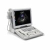 Portable Ultrasound Machines