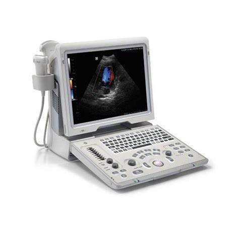 Portable Ultrasound Machines