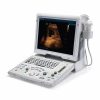 Portable Ultrasound Machines