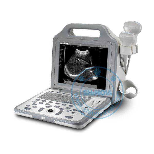Portable Ultrasound Machines