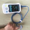 Handset Spo2 Temp Handheld Pulse Oximeter at JOMEX MEDICAL SUPPLIES