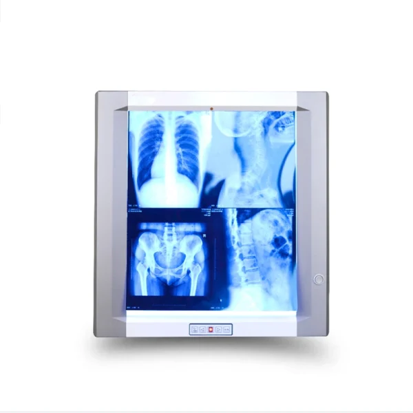 Single-Bank-LED-X-Ray-Medical-Film-Viewer-with-Film-Sensor X-Ray Film Viewer Single Digital LED Screen