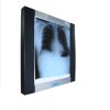 X-Ray-Viewing-Box-Single-Film X-Ray Film Viewer Single Digital LED Screen