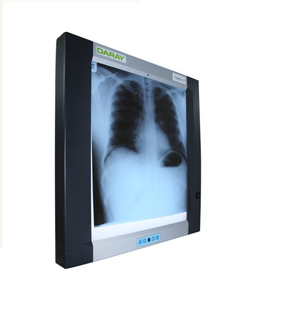 X-Ray-Viewing-Box-Single-Film X-Ray Film Viewer Single Digital LED Screen