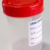 Urine Collection Container, for Hospital,