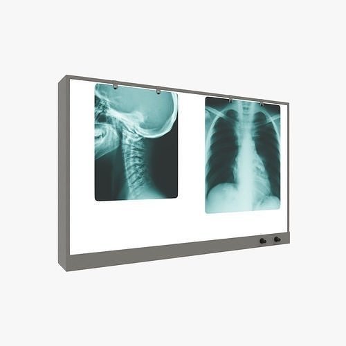 LED Double X-ray Viewing Box
