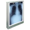 x-ray-viewer X-Ray Film Viewer Single Digital LED Screen