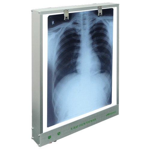 x-ray-viewer X-Ray Film Viewer Single Digital LED Screen