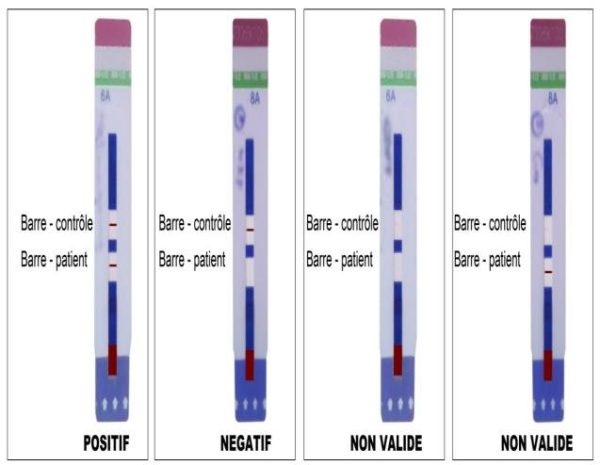 Determine HIV-1/2 Diagnostic Kit for Hospital at JOMEX MEDICAL SUPPLIES