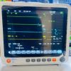 Multi parameter Patient Monitor